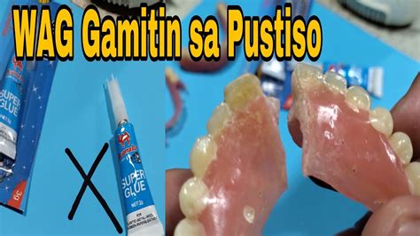 pandikit sa naputol na pustiso|Mga Dapat Mong Malaman Tungkol sa Pustiso .